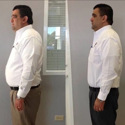 لاغری بدون عوارض و بازگشت