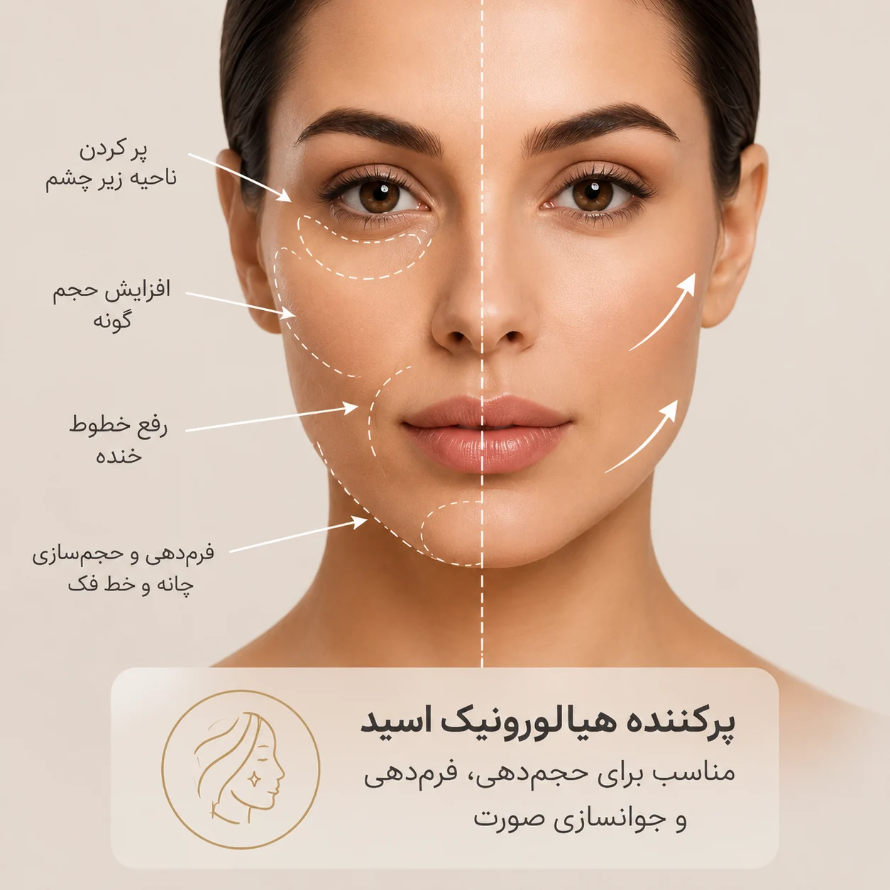 دوره پر شدگی صورت